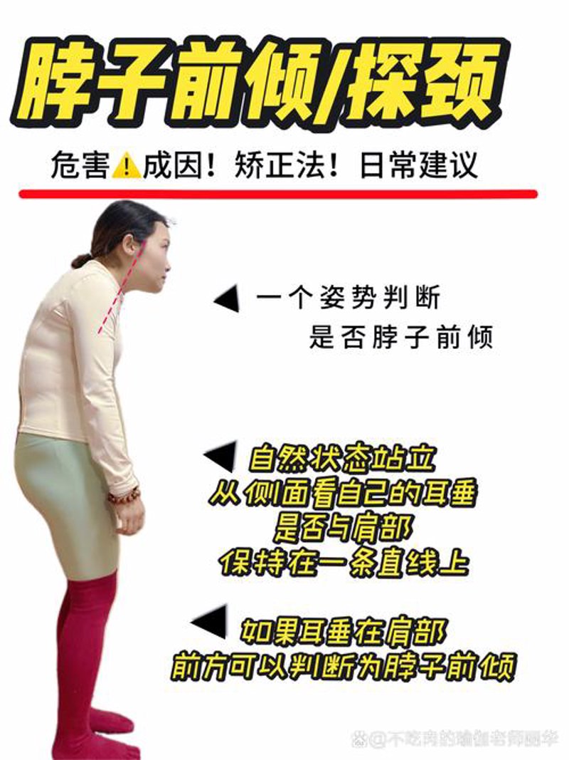 体态纠正